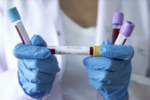 COVID-19: новая вспышка коронавируса ожидается  в Украине в течение ближайших 2-х недель – прогноз